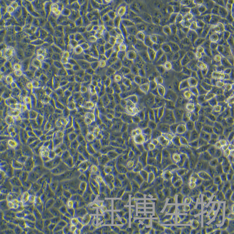 PANC-1（人胰腺癌细胞）YB-71184HC