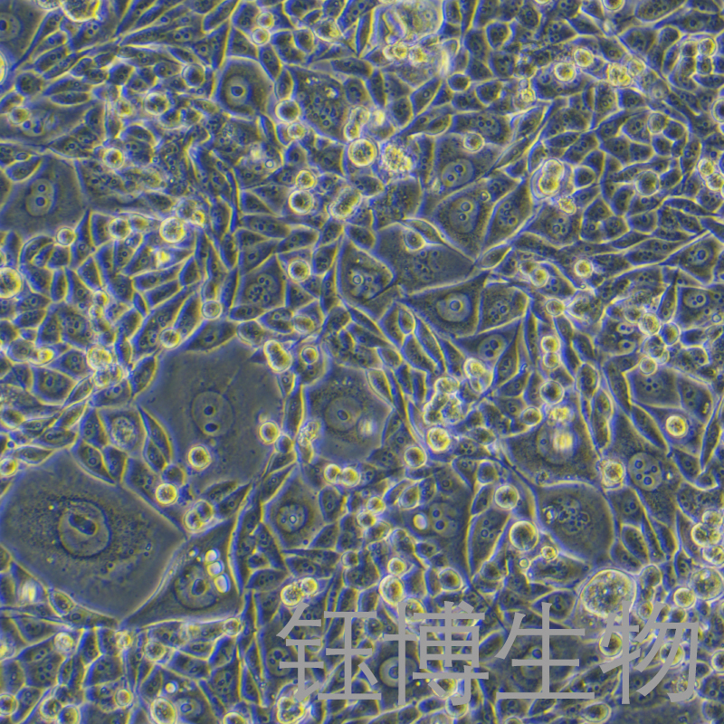PC-3（人前列腺癌细胞）YB-71185HC