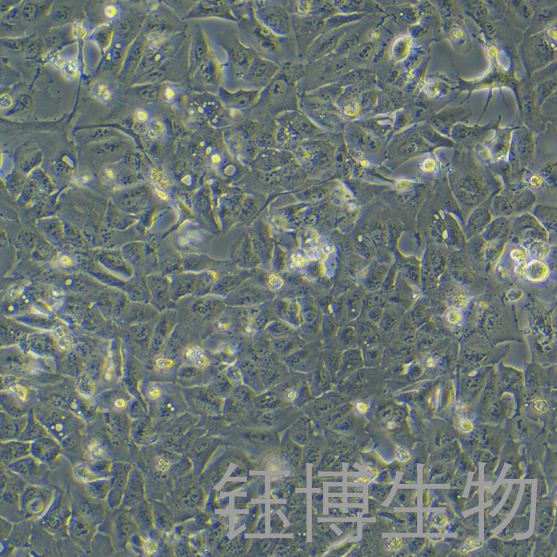 RBE（人肝胆管癌细胞）YB-71191HC