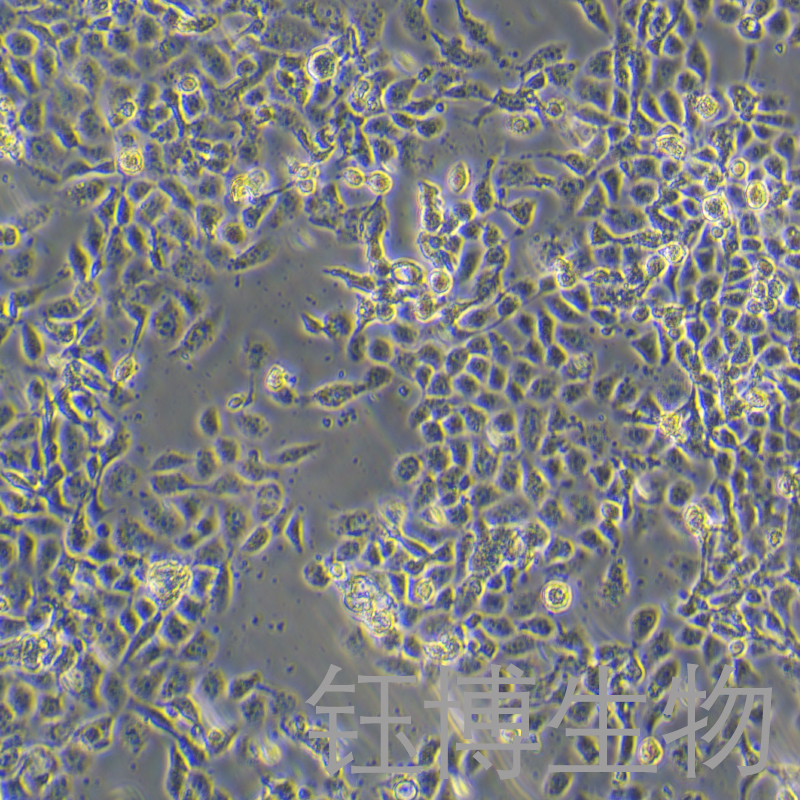 RL95-2（人子宫内膜癌细胞）YB-71197HC