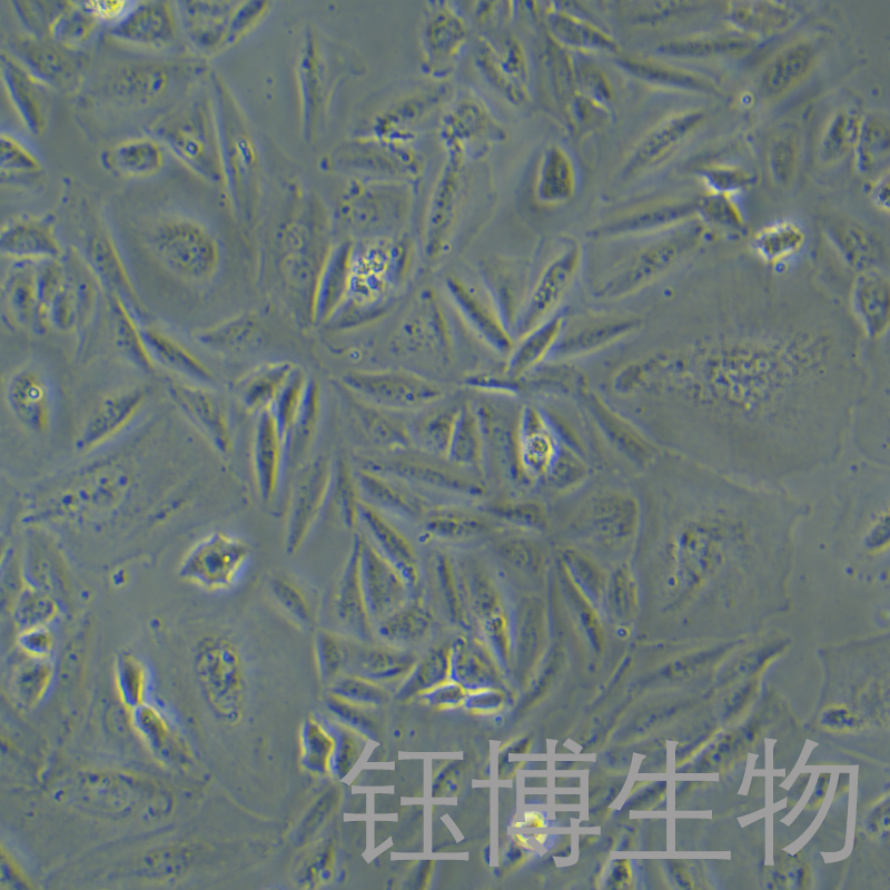 Saos-2（人成骨肉瘤细胞）YB-71202HC