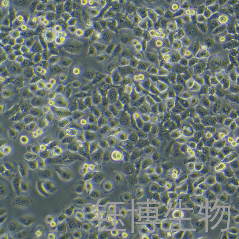 SGC-7901（人胃癌细胞）YB-71206HC