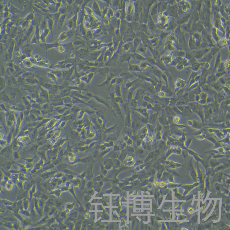 SH-SY5Y [SHSY-5Y]（人神经母细胞瘤细胞）YB-71208HC