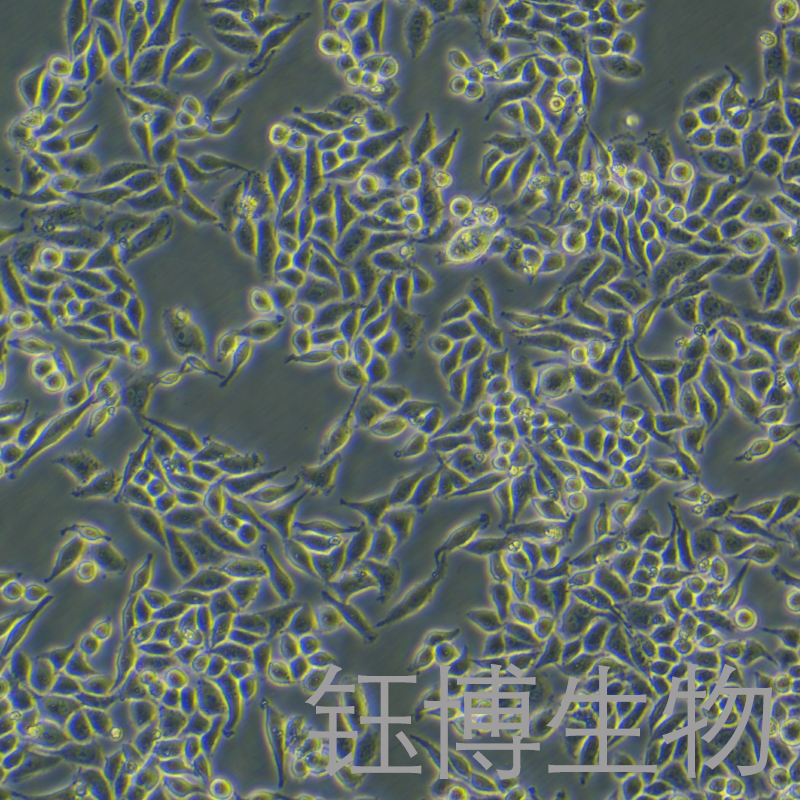 SiHa（人子宫颈鳞癌细胞）YB-71210HC