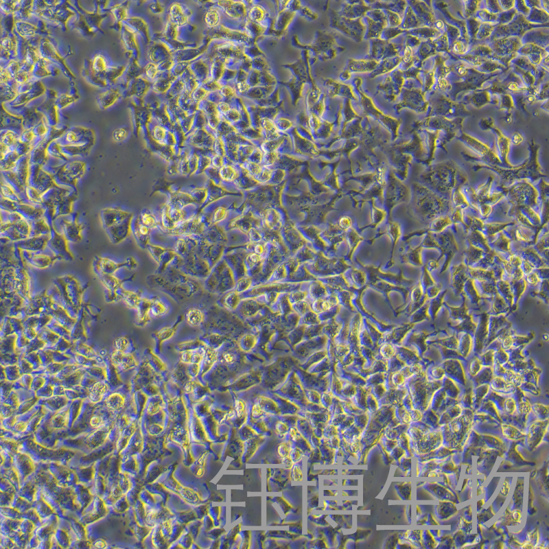 SK-BR-3 [SKBR3]（人乳腺腺癌细胞）YB-71211HC