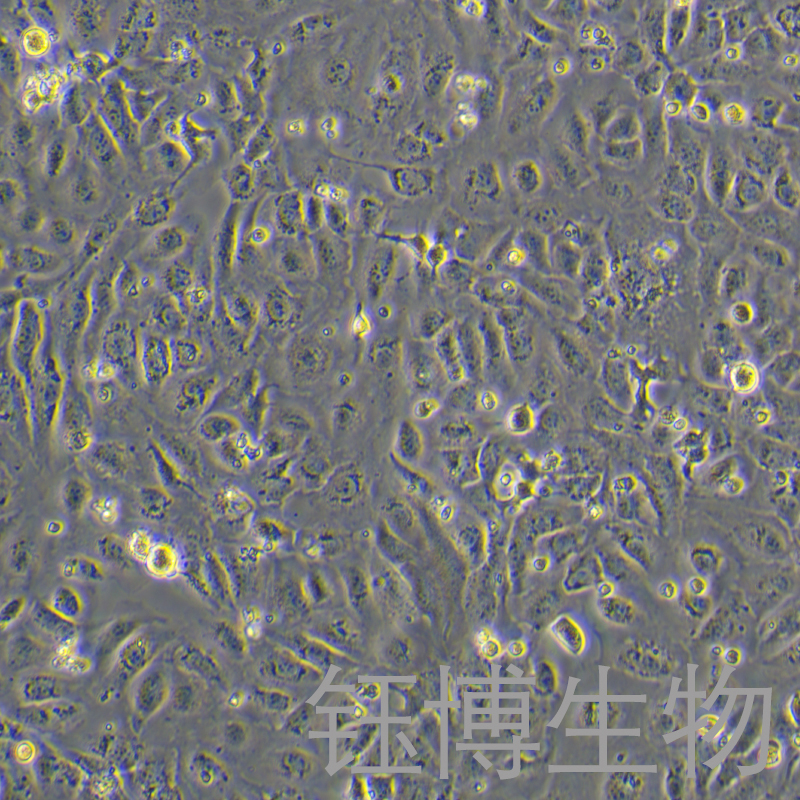 SK-OV-3（人卵巢癌细胞）YB-71215HC