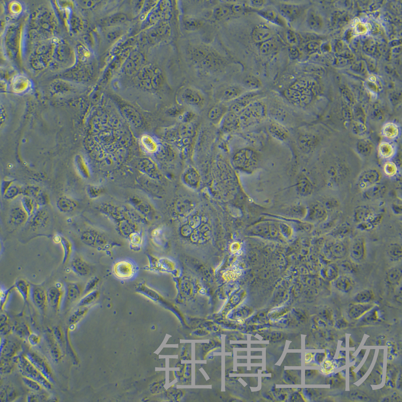 SV-HUC-1（人输尿管上皮永生化细胞）YB-71222HC