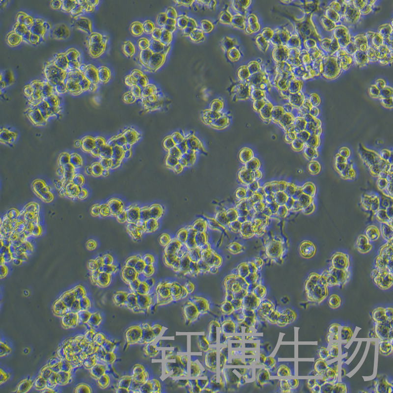 Neuro-2a（小鼠脑神经瘤细胞）YB-72168MC