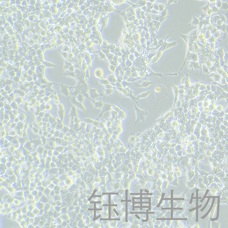 NG108-15 [108CC15]（小鼠神经细胞瘤与大鼠神经胶质瘤之融合细胞）YB-72170MC