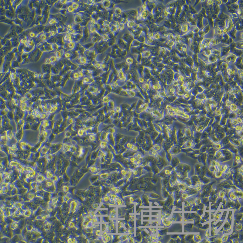 RM-1（小鼠前列腺癌细胞）YB-72198MC