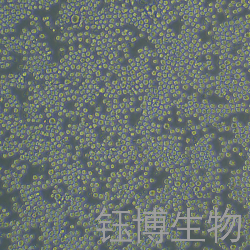 SP2/0（小鼠骨髓瘤细胞）YB-72217MC