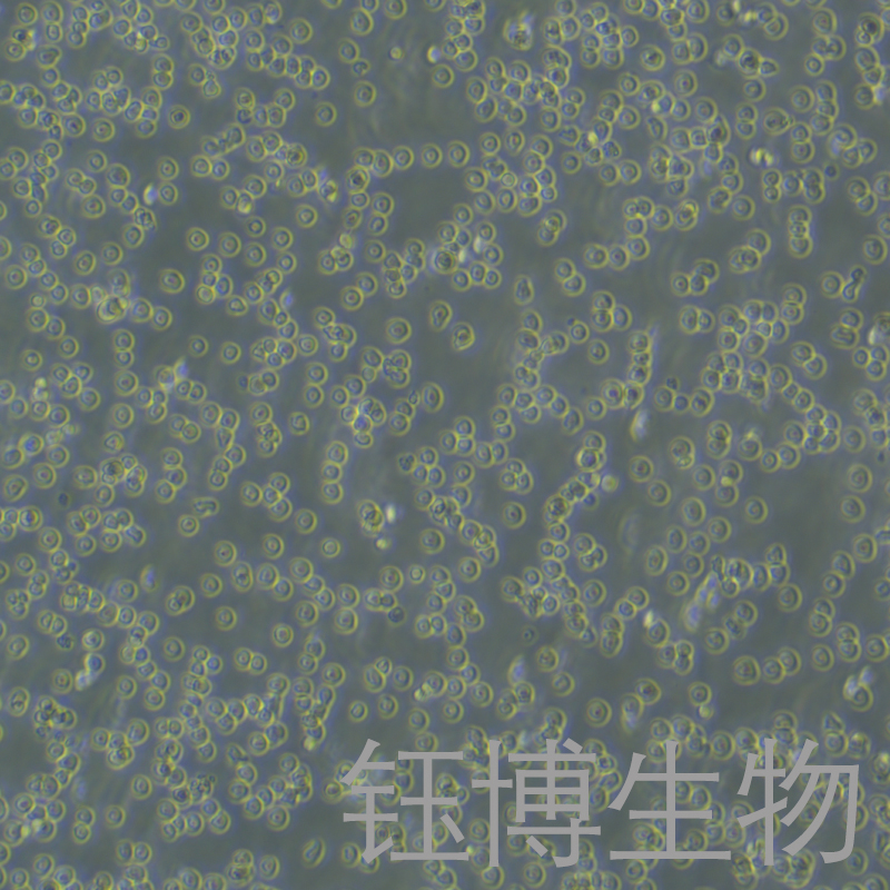 YAC-1（小鼠淋巴瘤细胞）YB-72246MC