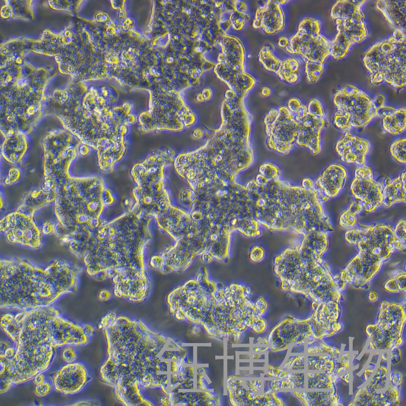 T84（人结肠腺癌肺转移细胞）YB-71229HC