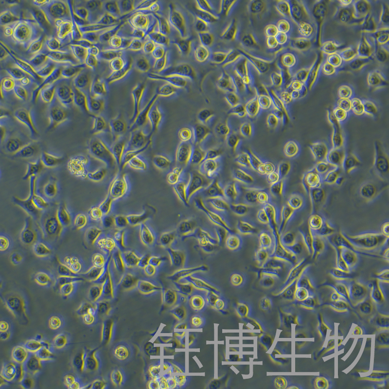 TE-1（人食管癌细胞）YB-71231HC