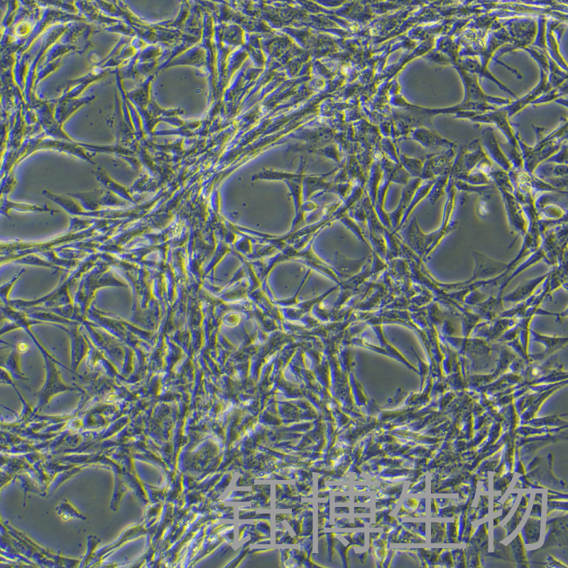 U-87 MG（人脑星形胶质母细胞瘤细胞）YB-71238HC