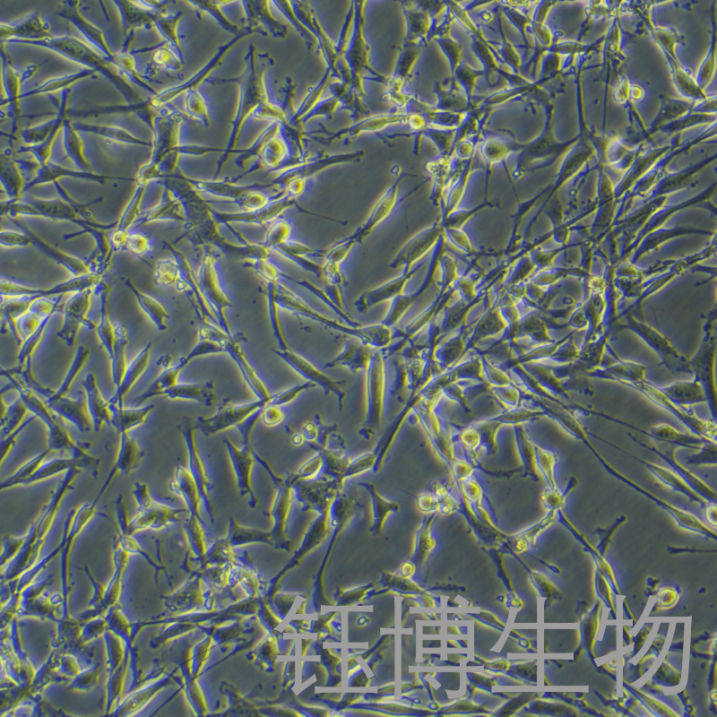 U-118 MG（人脑星形胶质母细胞瘤）YB-71458HC