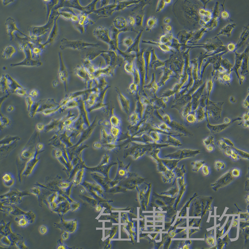 U251（人胶质瘤细胞）YB-71237HC