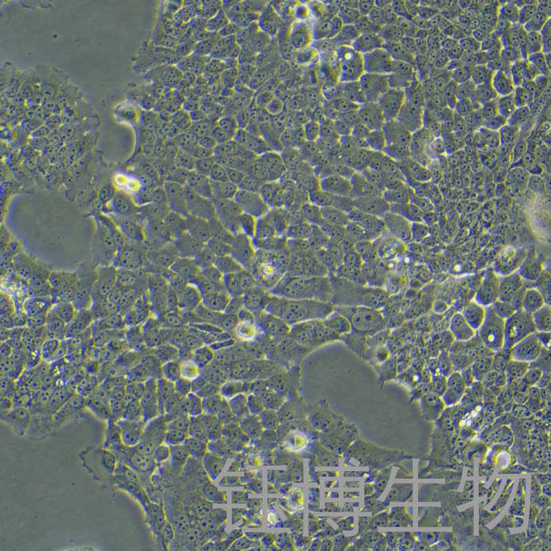 ZR-75-30（人乳腺癌细胞）YB-71248HC