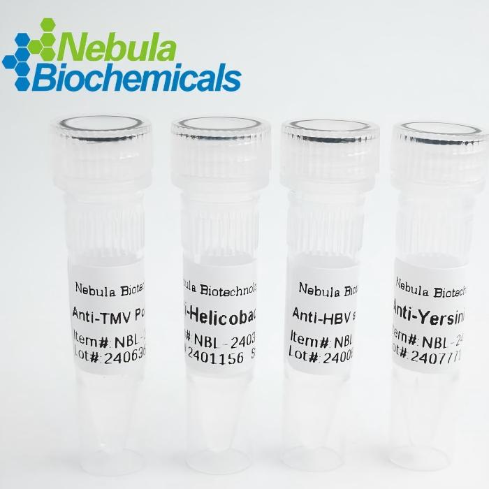 抗基孔肯雅病毒E1（CHIKV）多克隆抗体|Chikungunya Virus E1 Polyclonal Antibody|NBAB-160096