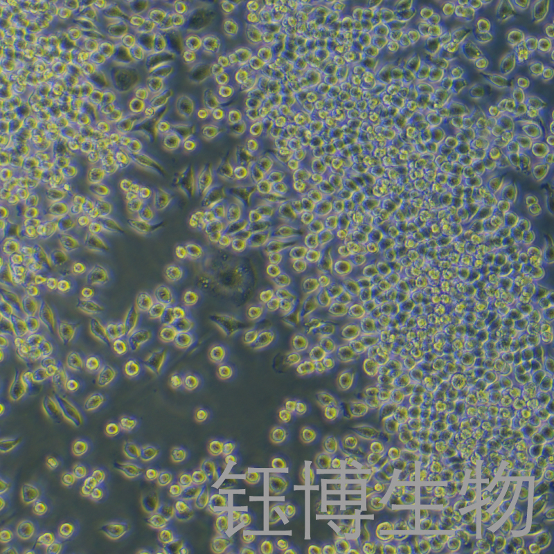 J774A.1（小鼠单核巨噬细胞）YB-72370MC