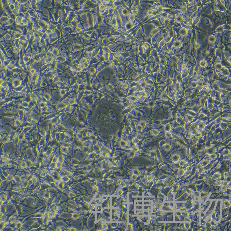 K7M2 wt [K7M2-WT]（小鼠骨肉瘤成骨细胞）YB-72371MC