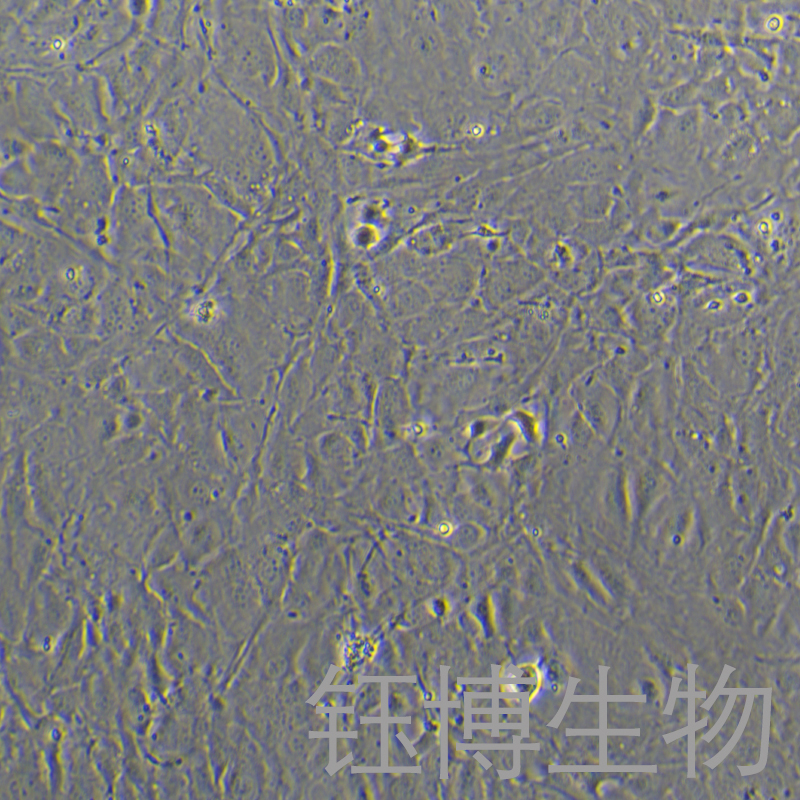 MC3T3-E1 Subclone 14（小鼠颅顶前骨细胞亚克隆14）YB-72378MC