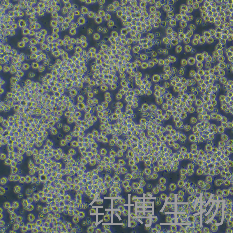 AE-2（小鼠杂交瘤细胞（抗AChE））YB-72472MC