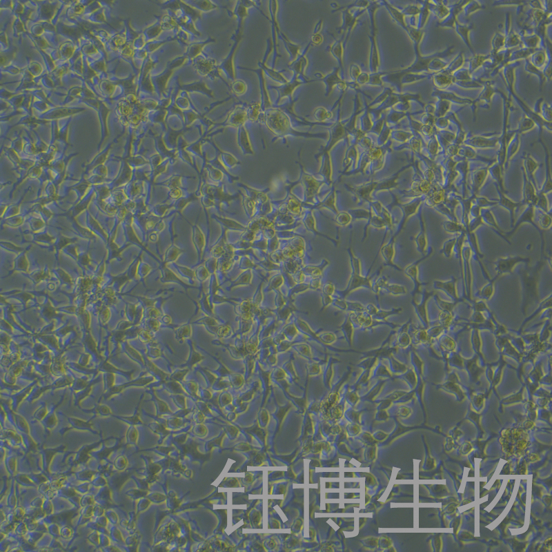 MLO-Y4 [MLOY4]（小鼠骨样细胞）YB-72567MC