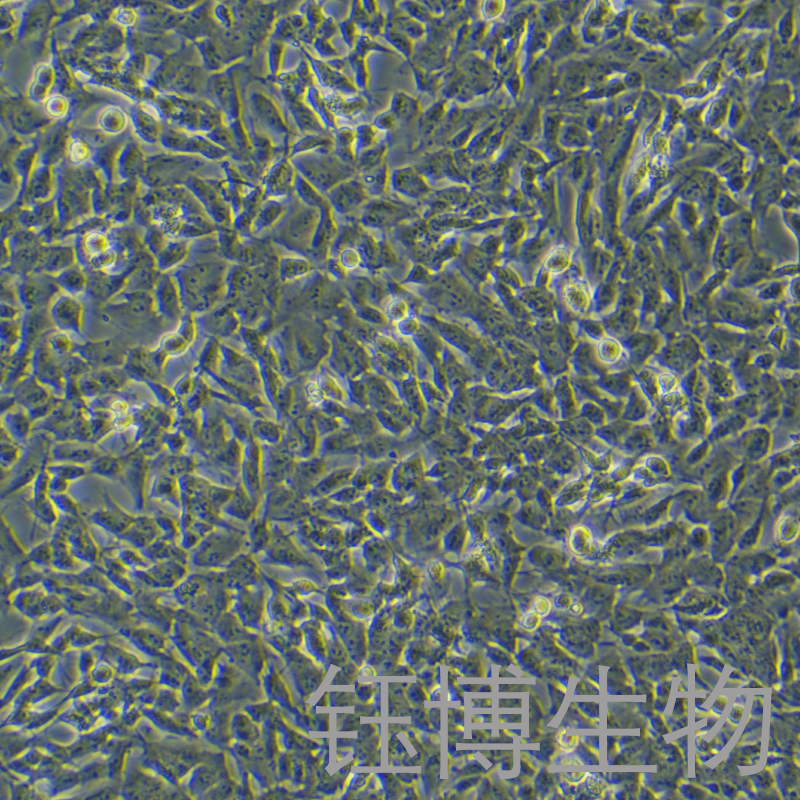 AML-12（小鼠正常肝细胞）YB-72602MC