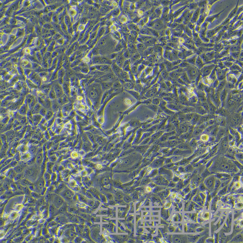 MDBK [NBL-1]（牛肾细胞）YB-75153OC