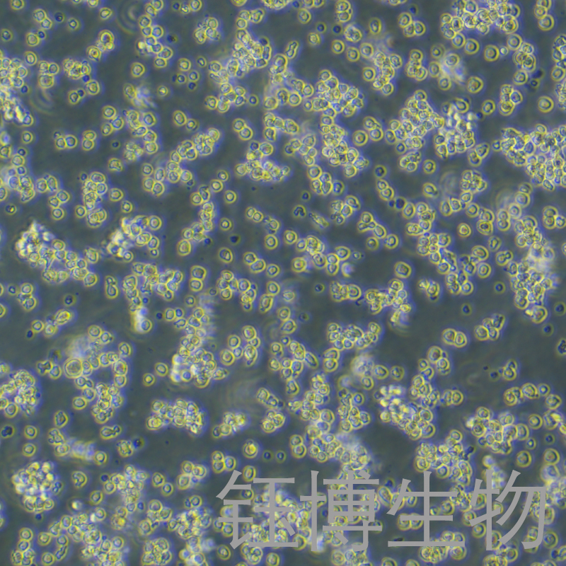 DT40（鸡淋巴瘤细胞）YB-75555OC