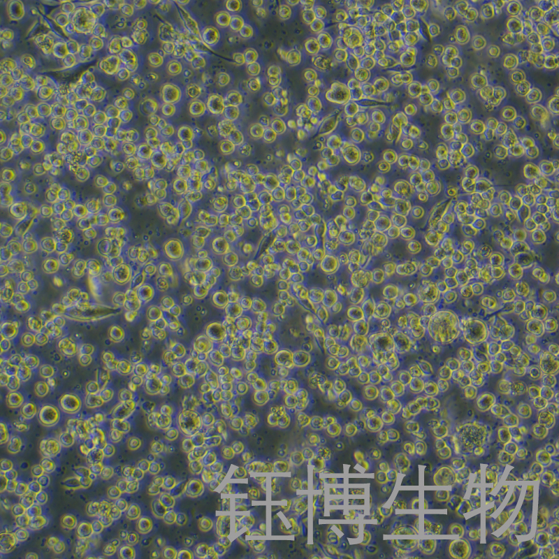 H22-LUC-GFP-PURO（双标记的小鼠肝癌细胞）YB-72341MC-LGP