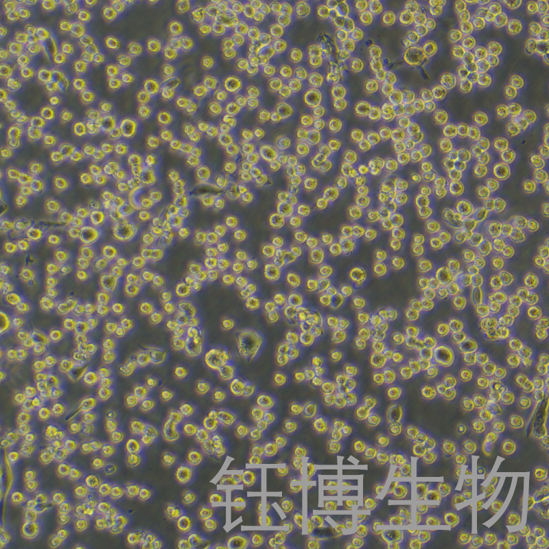 LLC-LUC-GFP-PURO（双标记的小鼠肺癌细胞）YB-72140MC-LGP