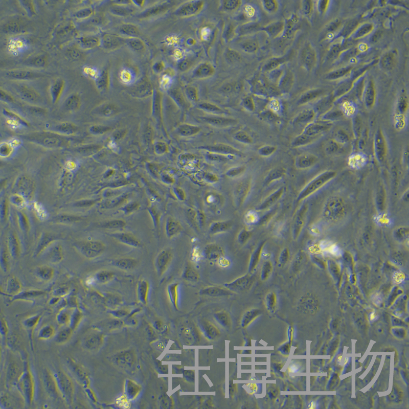 HUVEC-RFP（人脐静脉血管内皮细胞带红色荧光）YB-71122HC-R