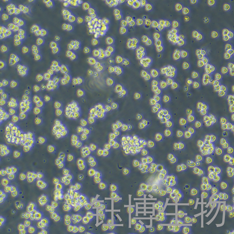 RAJI-LUC（人口腔鳞癌细胞-荧光素酶标记）YB-71189HC-L