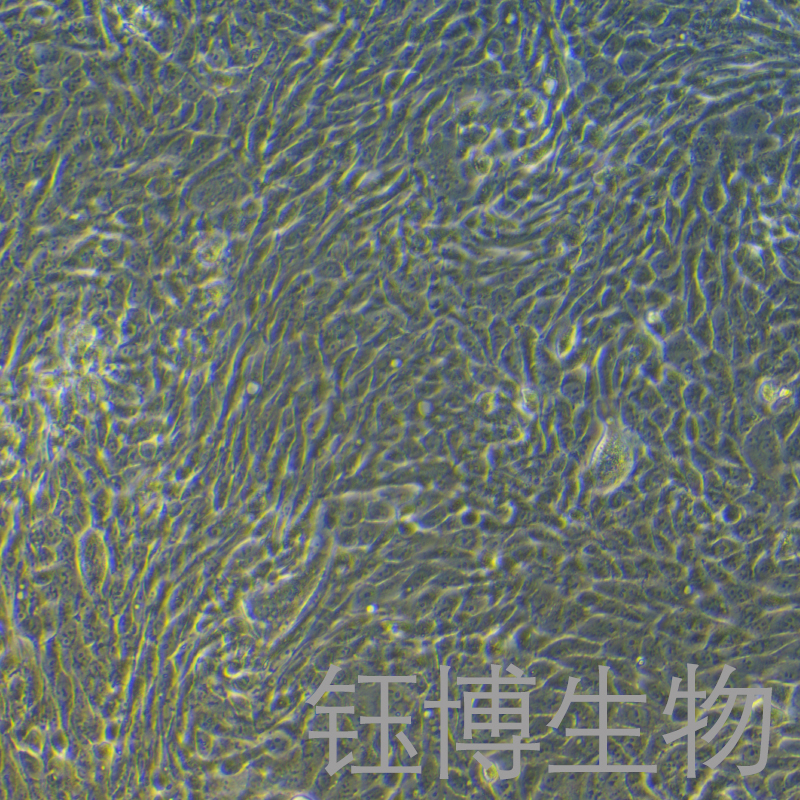 CFPAC-1（人胰腺癌细胞）YB-71601HC