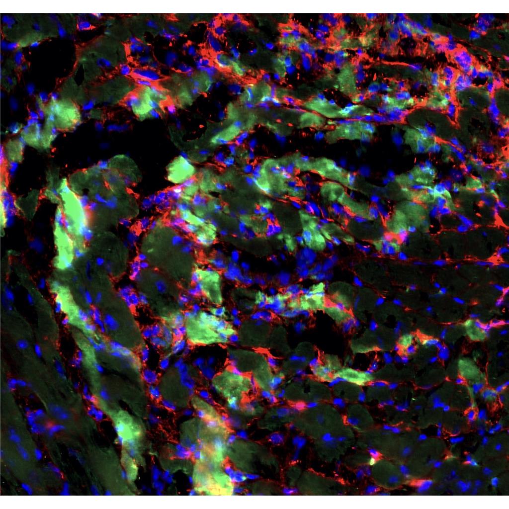 人套细胞淋巴瘤细胞Jeko-1