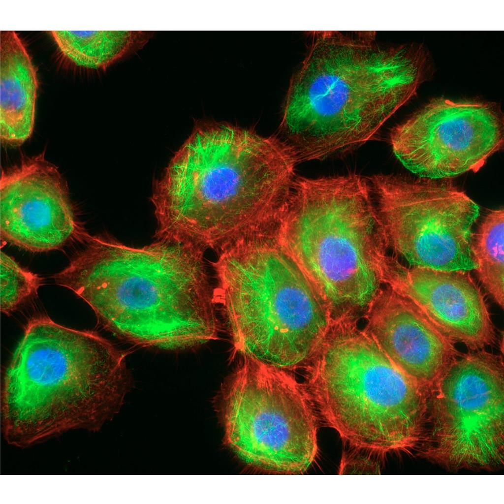 人套细胞淋巴瘤细胞Jeko-1