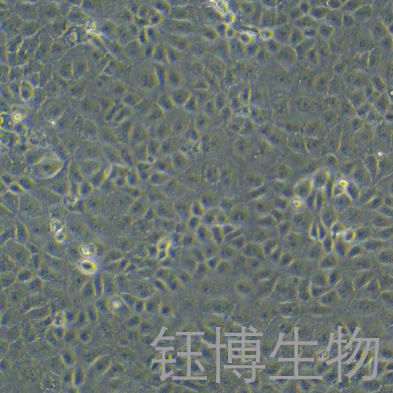 HK-2（人肾皮质近曲小管上皮细胞）YB-71602HC