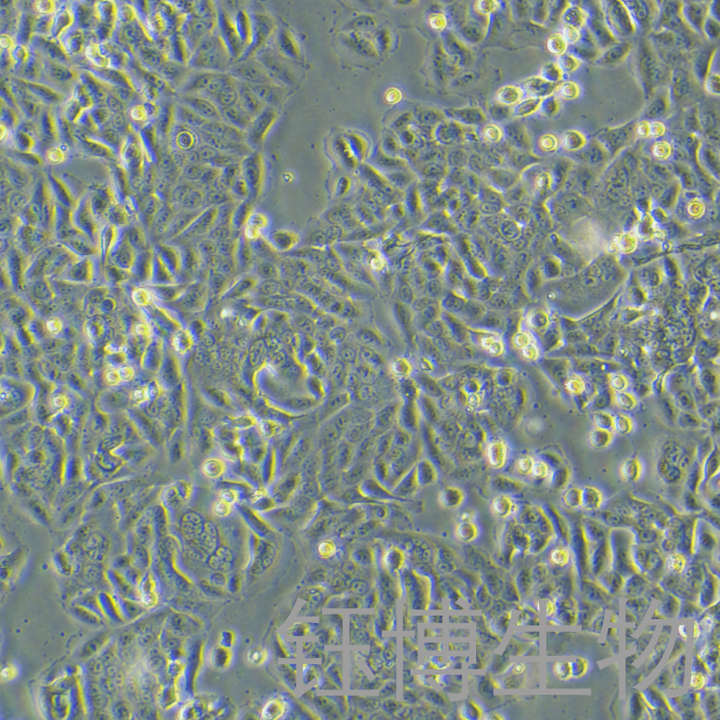 SW480 [SW-480]（人结肠癌细胞）YB-71605HC