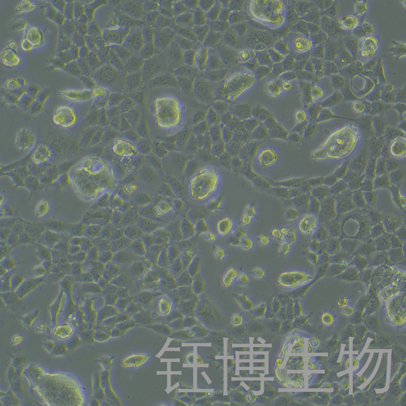 NCI-H508[H508]（人结肠直肠腺癌细胞）YB-71619HC