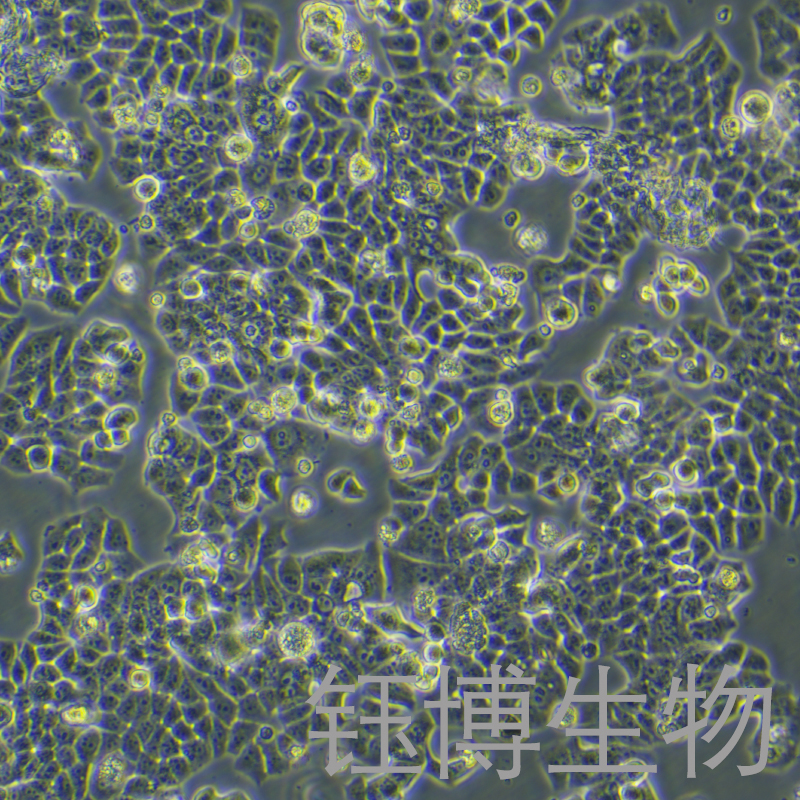 T47D（人乳腺导管癌细胞）YB-71684HC