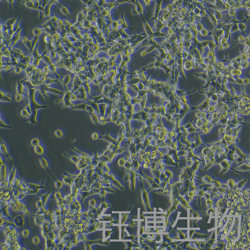 Lncap（人前列腺癌细胞）YB-71683HC