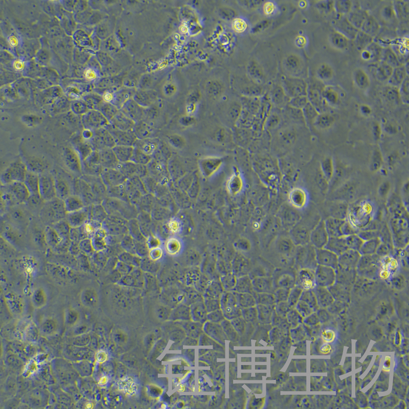 SCC-9（人类鳞状上皮舌癌细胞）YB-71686HC