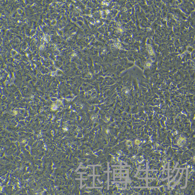 GT1-1（小鼠垂体瘤细胞）YB-7007MC