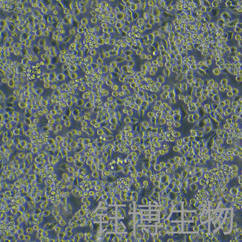 G422（小鼠脑神经胶质母细胞瘤瘤株）YB-7006MC