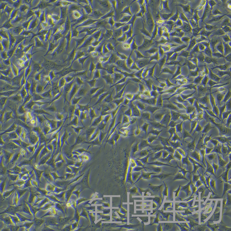 ATDC5（小鼠胚胎瘤细胞）YB-7010MC