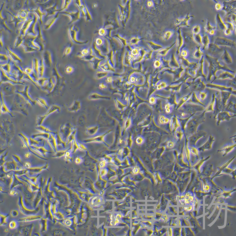 HCC1954（人乳腺导管癌细胞）YB-71700HC