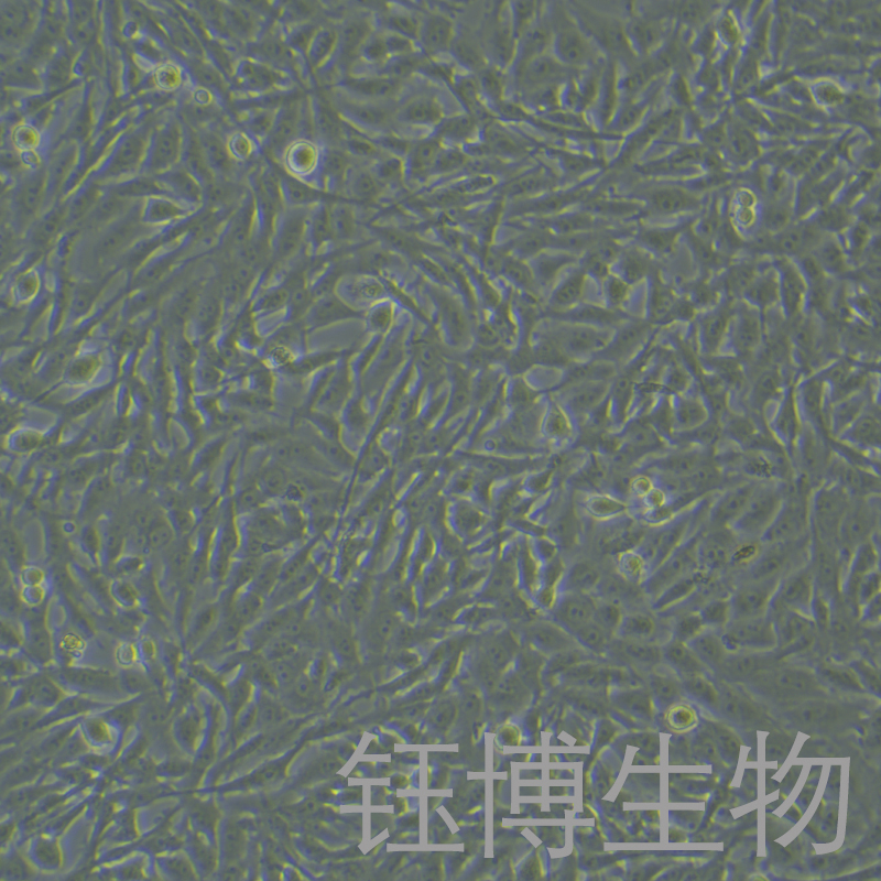 U251 MG（人神经胶质细胞瘤细胞）YB-71702HC