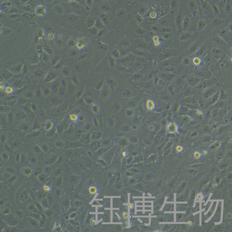 HuCCT1（人胆管癌细胞）YB-71709HC